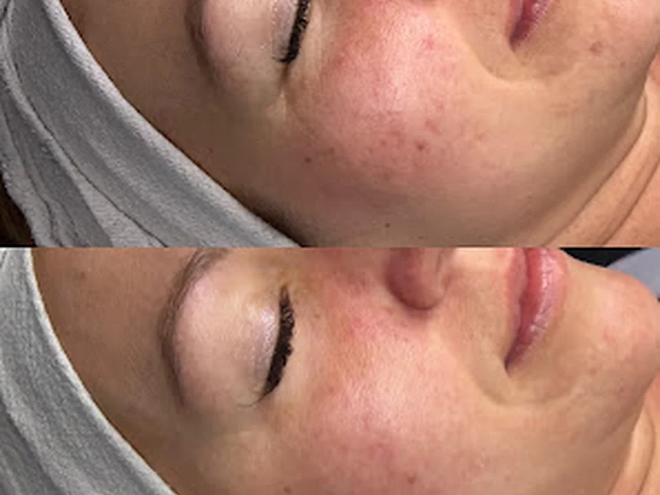 Healing Vibes Esthetics, Denver